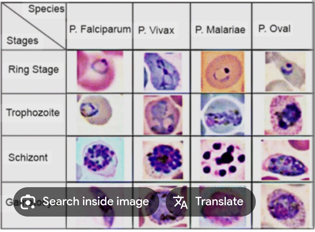 A254➡️Malarial Parasite (Mp)