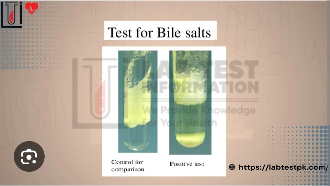 A265➡️ bile salt and bile pigment urine 