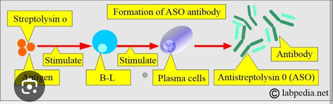 266➡️ASO Titer (Antistreptolysin O titer)