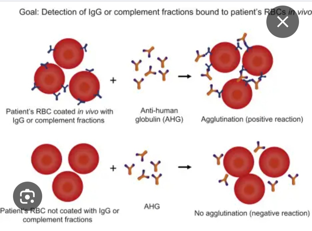 A267➡️indirect Coombs test(ICT)
