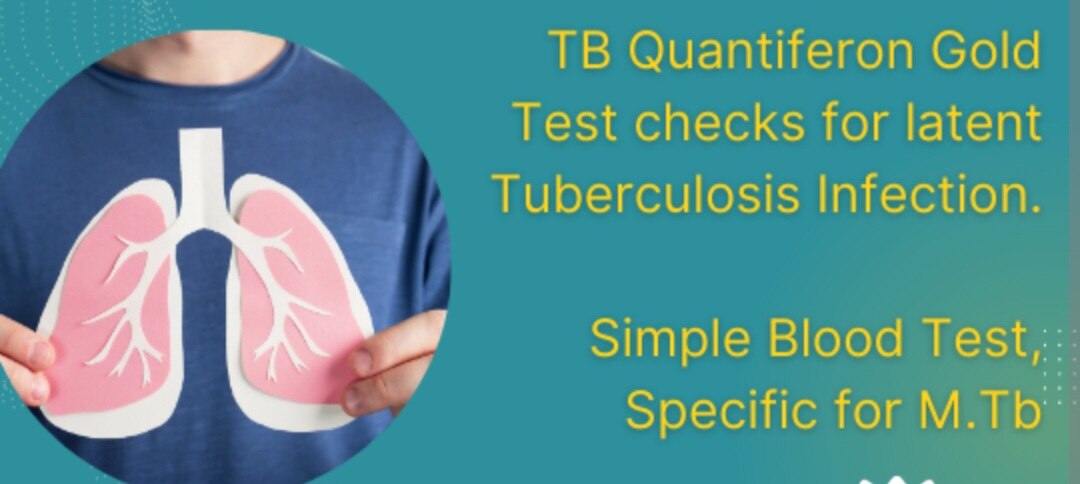 A278➡️QuantiFERON-TB Gold