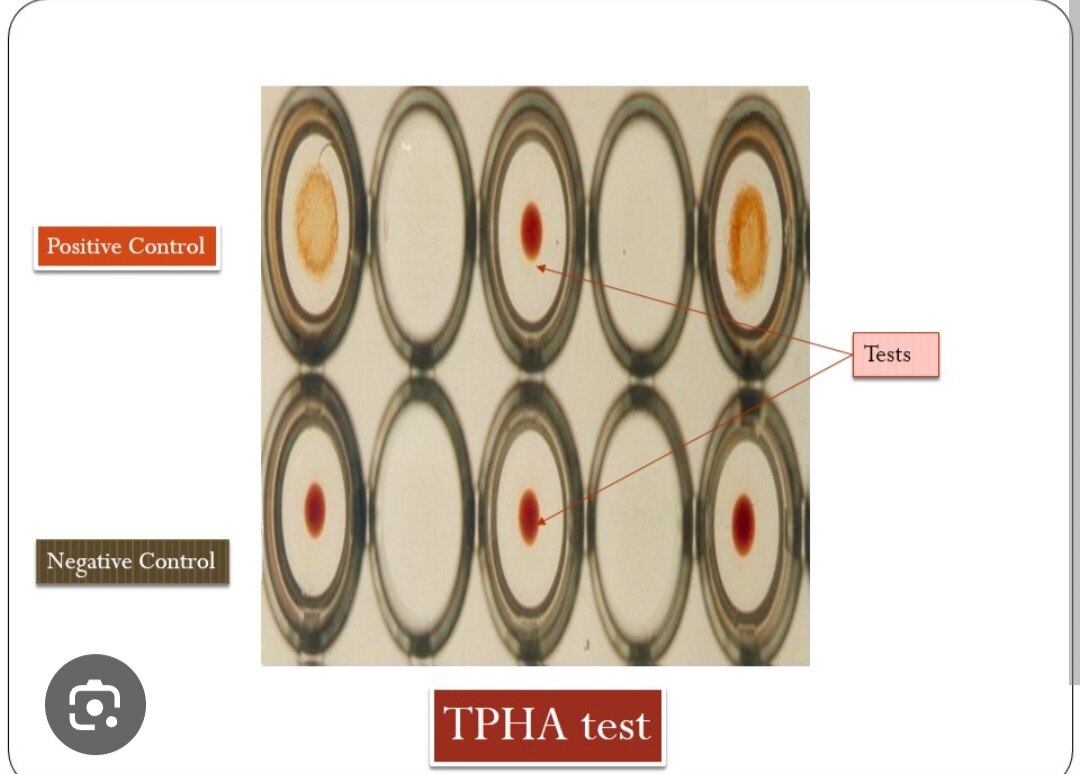 A279➡️TPHA (Treponema Pallidum Hemagglutination Assay), Serum
