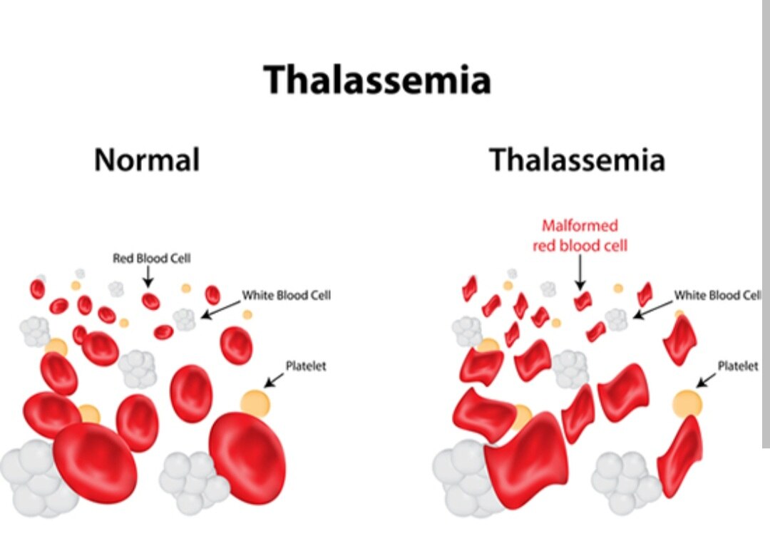 A281➡️Thalassemia Studies