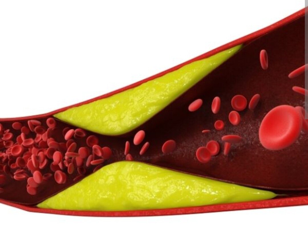 A283➡️Thrombophilia Profile - Mini