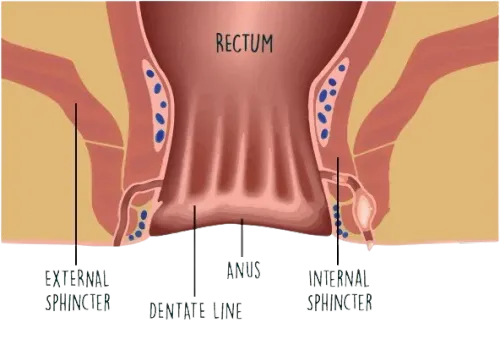 Piles,Fissure,Fistula Surgeon in Thane service image
