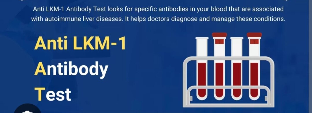 A304➡️LKM1 (Liver Kidney Microsome) Antibody, Serum