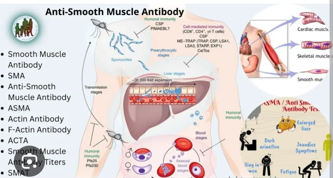 A305➡️ASMA Smooth Muscle Antibody, Serum