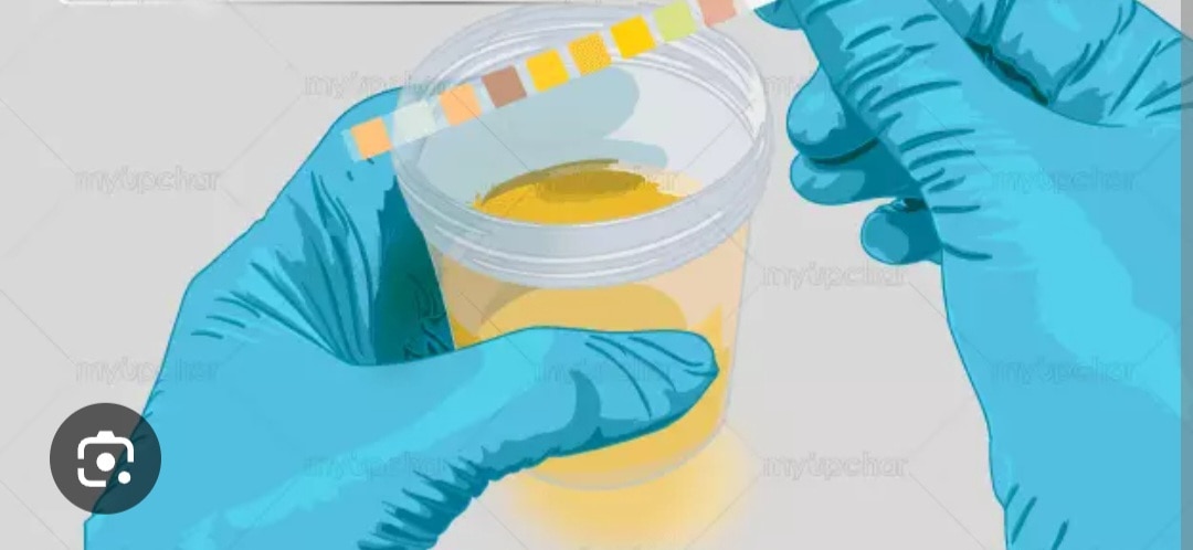 A320➡️Calcium / Creatinine Ratio, Urine