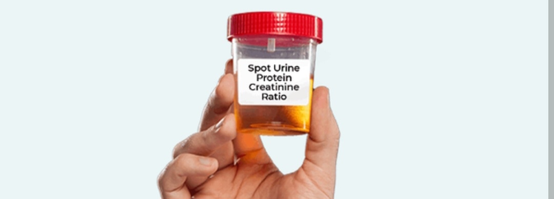 A322➡️Proteins / Creatinine Ratio, Urine