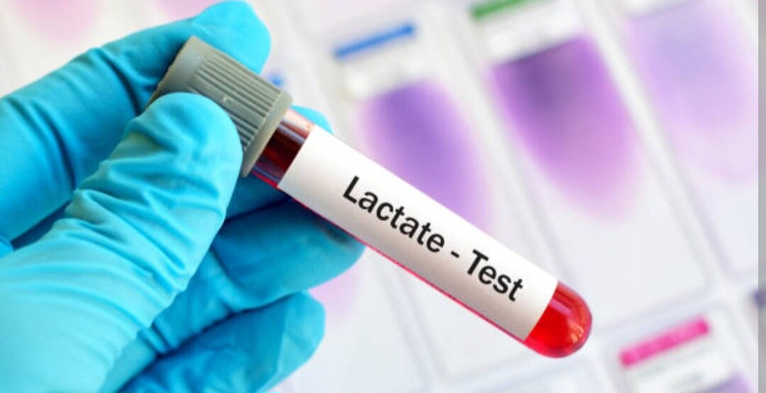 A326➡️Lactate, Plasma(LACTIC ACID)