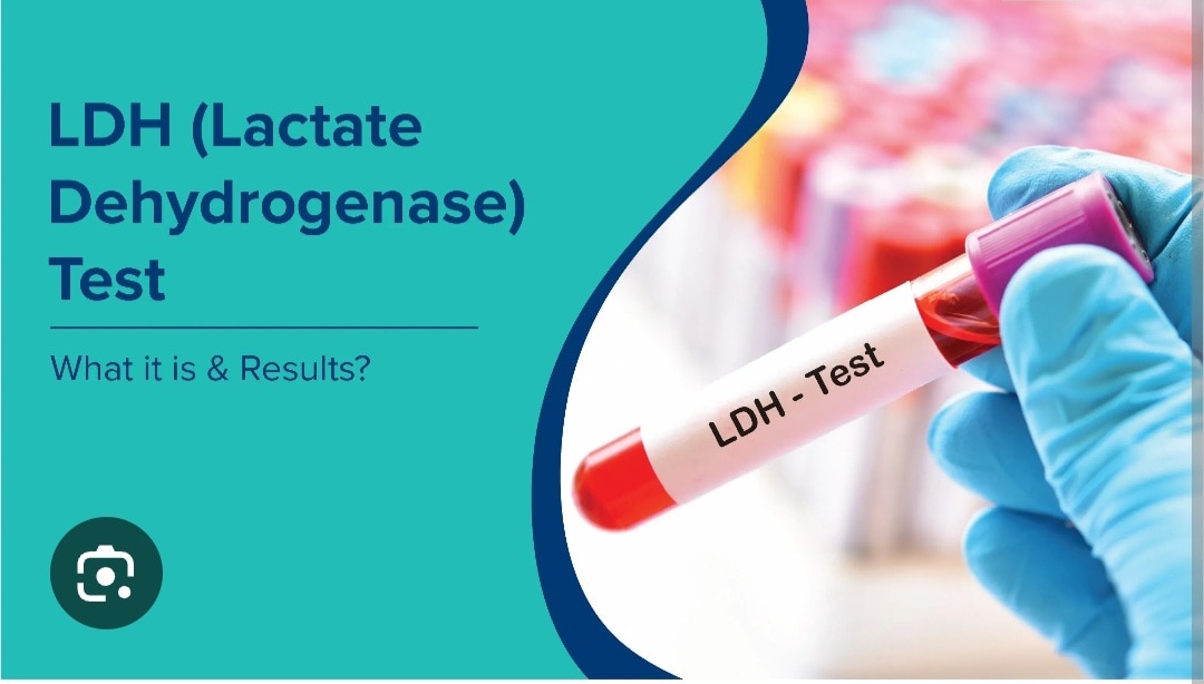 A328➡️LDH (Lactate Dehydrogenase), Body fluid