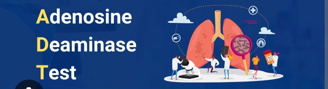 A329➡️ADA (Adenosine Deaminase), Serum