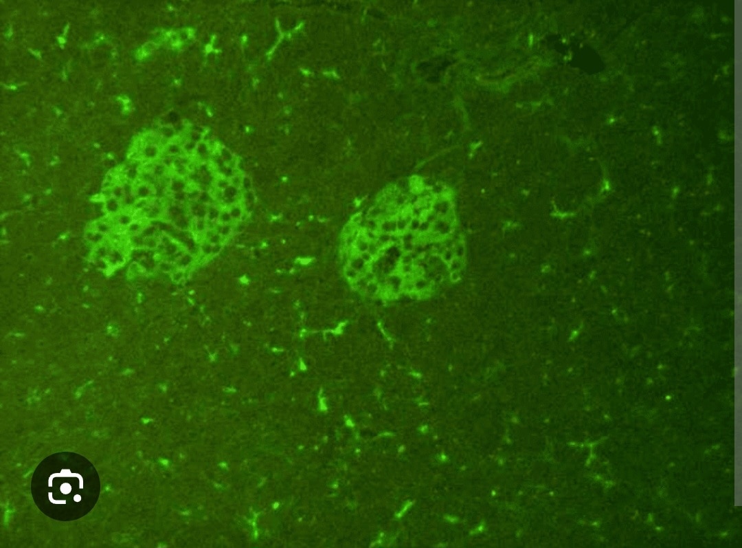 A347➡️Islet Cell Antibody, Serum