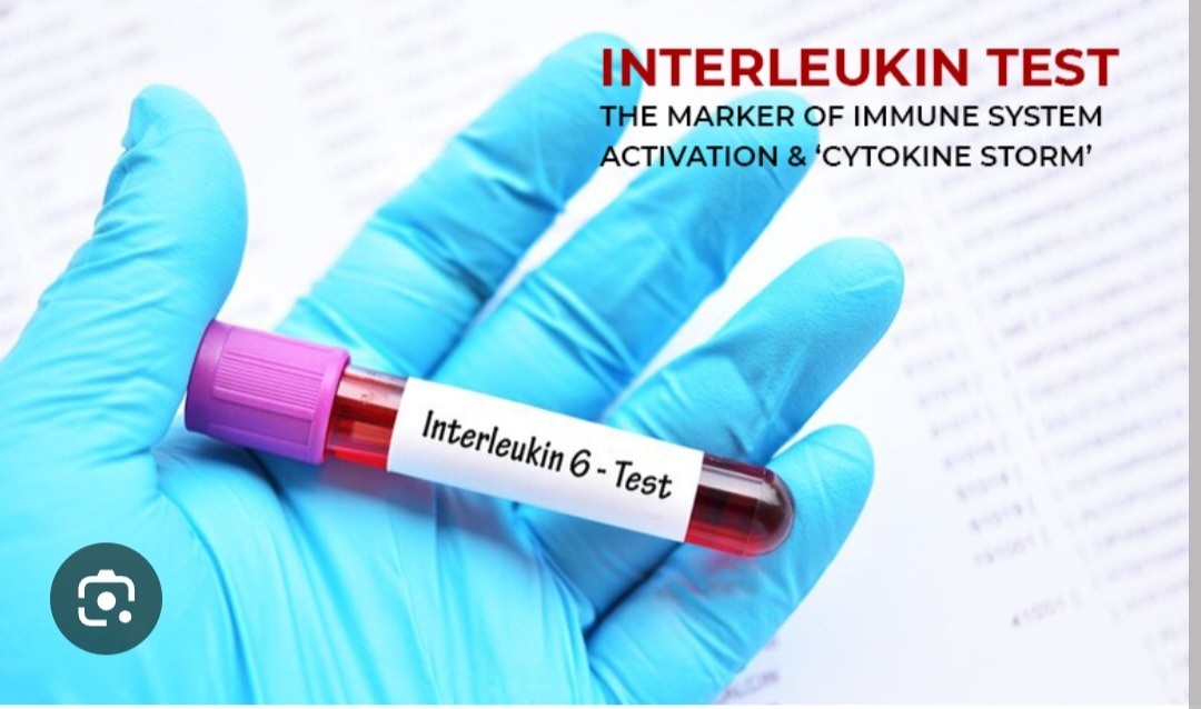 A348➡️Interleukin-6, EDTA Plasma