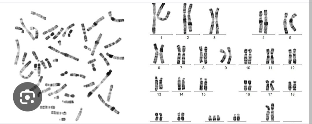 A349➡️Karyotyping by G-Banding, Heparin Blood