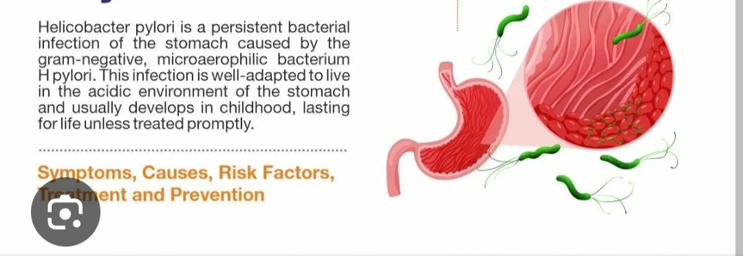 A351➡️Helicobacter Pylori - IgA antibody, Serum