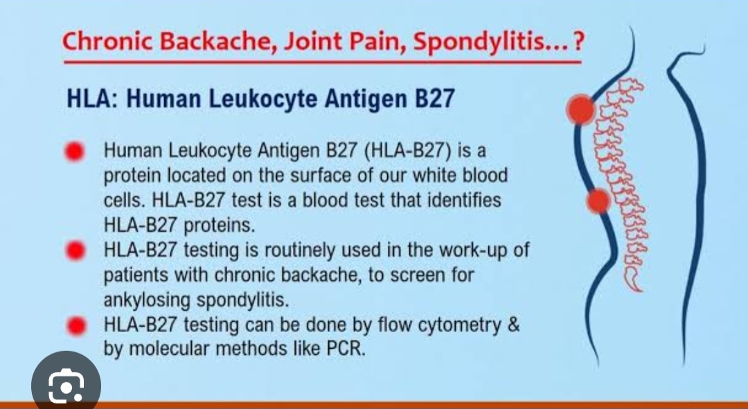 A360➡️HLA B27 (Human Leucocyte Antigen B27) Detection by Flow Cytometer, EDTA Blood
