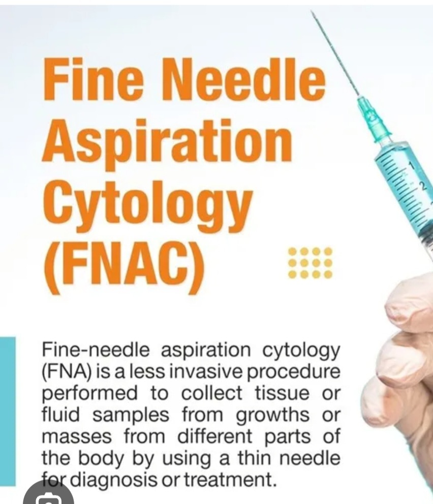 A369➡️FINE NEEDLE ASPIRATION CYTOLOGY ( FNAC )