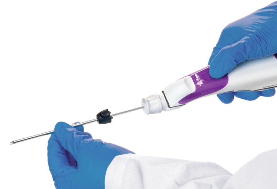 A376➡️Histopathological Examination -Breast Lump