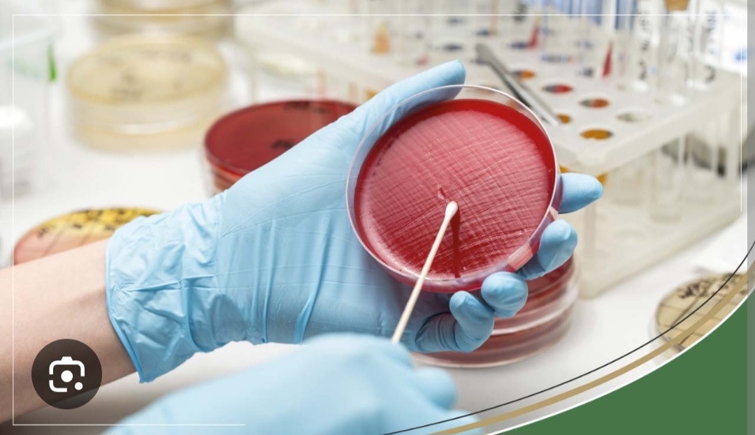 A379➡️Culture & Sensitivity - Aerobic bacteria, Urine