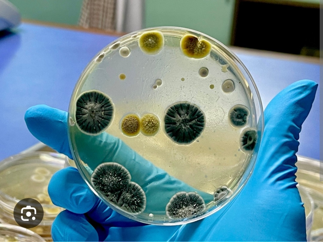 A381➡️Fungal stain, Culture & Identification, Urine