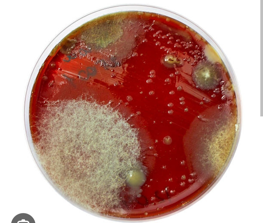 A384➡️Culture & Sensitivity - Aerobic bacteria, Stool