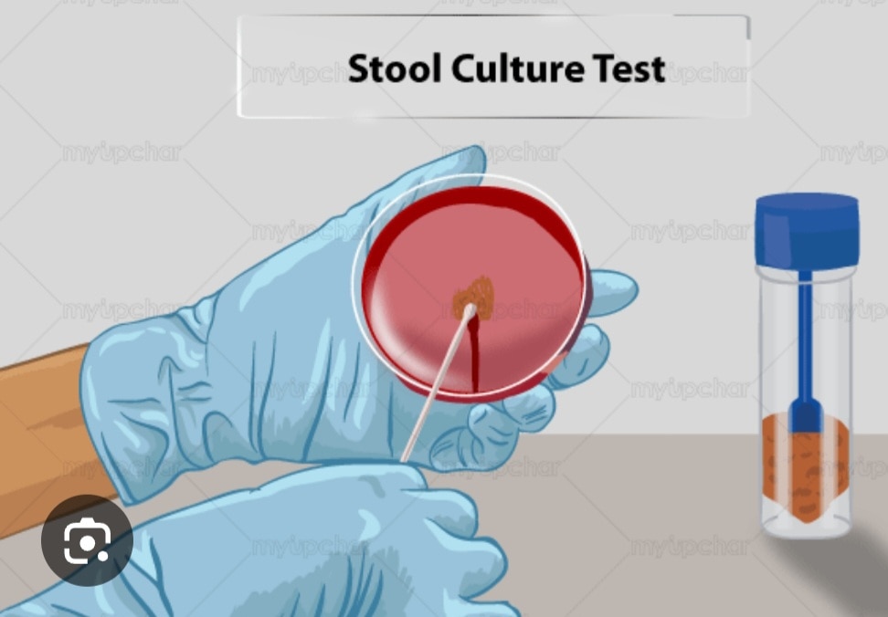 A385➡️Fungal stain, Culture & Identification, Stool