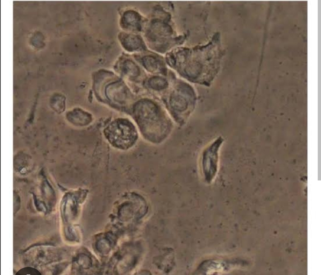 A392➡️Culture & Sensitivity - Aerobic bacteria, Vaginal sample