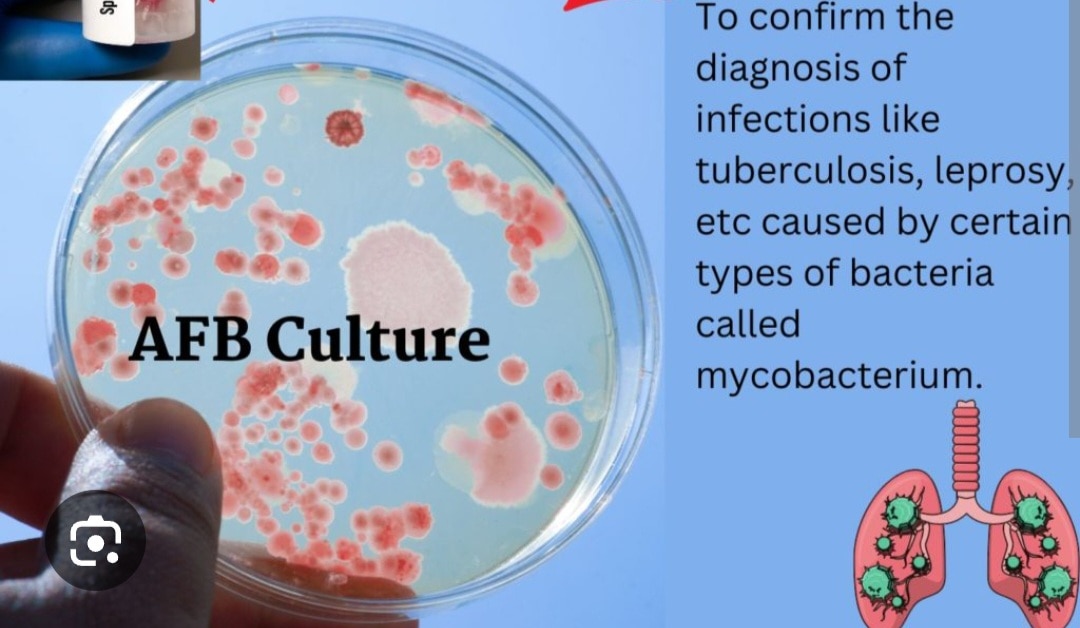 A397➡️AFB Rapid Culture, Body Fluid