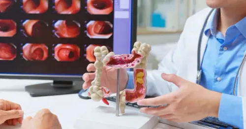 Colonoscopy service image