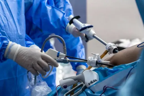 Laparoscopic Sleeve Gastrectomy service image