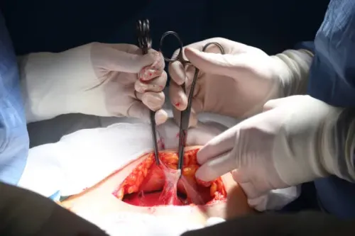 Thymectomy service image