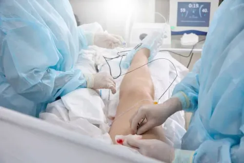 Laser Ablation of Pilonidal Sinus service image