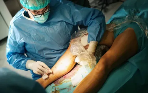 Laser Ablation of Hemorrhoids service image