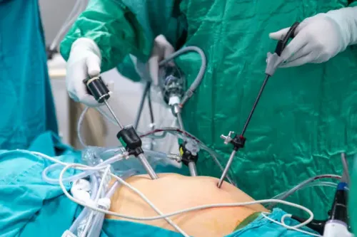 Laparoscopic Hepatic Resection service image