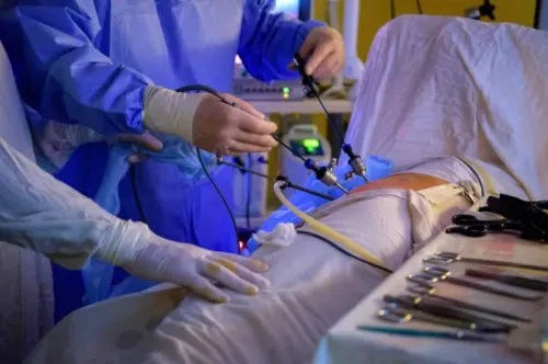 Laparoscopic Colonic Surgery service image