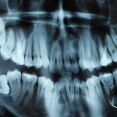 Digital Orthopantomogram (OPG) Service service image