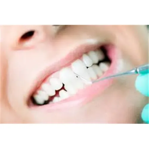 Cleaning and polishing of teeth service image