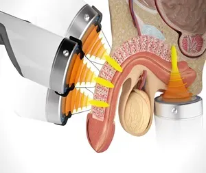 SHOCKWAVE THERAPY service image