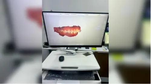 3D Intraoral Digital Scan service image