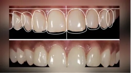 Smile Designing service image