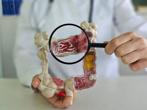 Colorectal Cancer Surgery service image