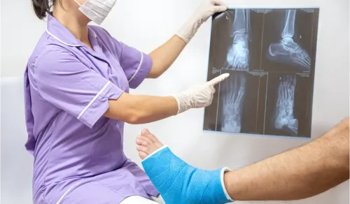 Fracture Treatment In Dadar service image