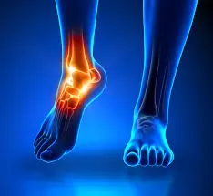 Ankle Surgery In Dadar service image