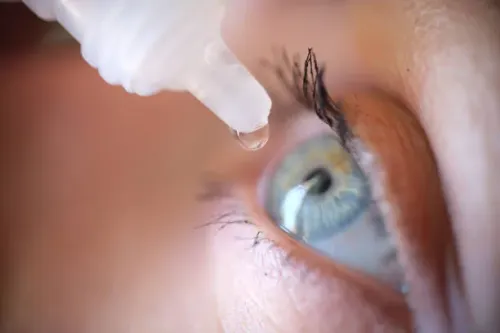 Dry Eye & Allergy Eye Treatment service image