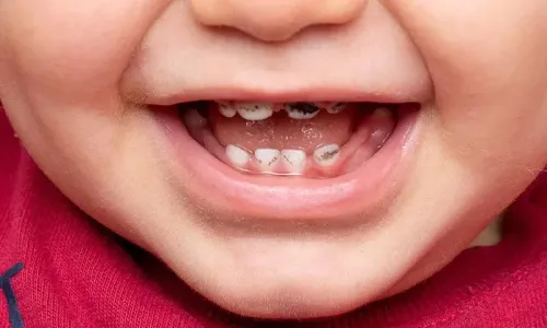 Kids dentistry service image
