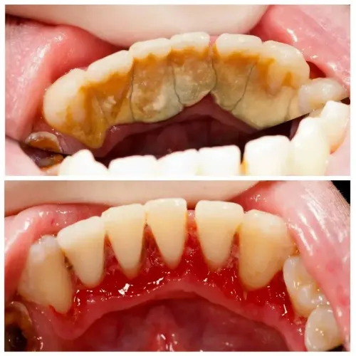Cleaning teeth service image
