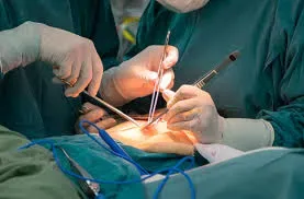 General Surgery service image