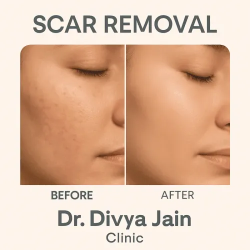 Scar Removal service image