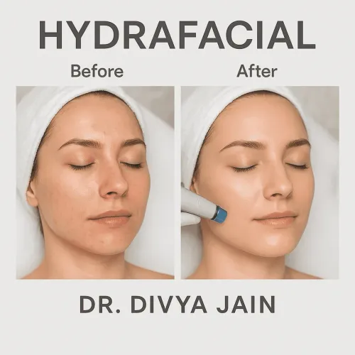 Hydra Facial service image